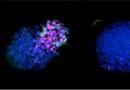 „Embryo-ähnliches“ Modell ahmt entscheidende Periode der menschlichen Entwicklung nach 